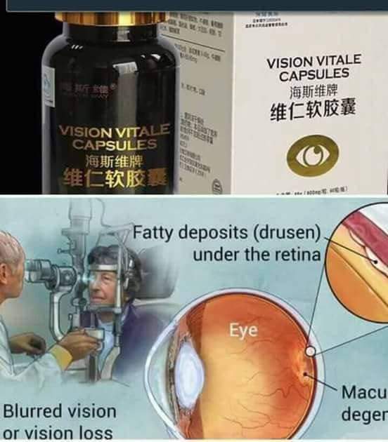 Vision Corrector